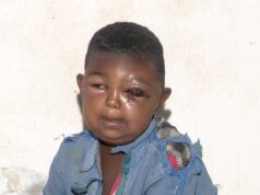 ብሕማም መገረም ዝሞቱ ወገናት